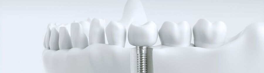 Dr. Hoffmann & Neumann | Zahnarzt in Braunschweig